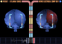 Brain Memory Centers Scanning