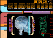 Cortical Scan